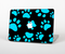 The Black & Turquoise Paw Print Skin Set for the Apple MacBook Pro 15"