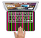 The Pink & Green Striped Skin Set for the Apple MacBook Pro 15" with Retina Display