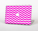 The Pink & White Chevron Pattern Skin Set for the Apple MacBook Pro 15" with Retina Display