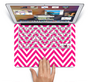 The Pink & White Sharp Chevron Pattern Skin Set for the Apple MacBook Pro 15" with Retina Display