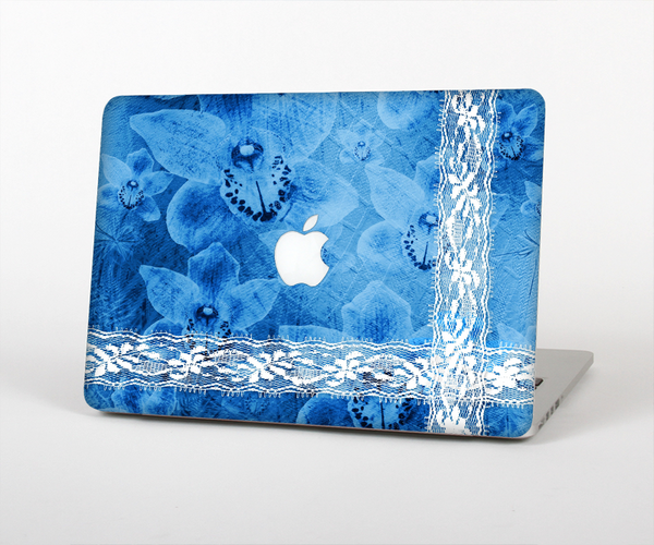 The Vibrant Blue & White Floral Lace Skin Set for the Apple MacBook Pro 15" with Retina Display