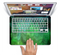 The Vivid Green Sagging Painted Surface Skin Set for the Apple MacBook Pro 15"