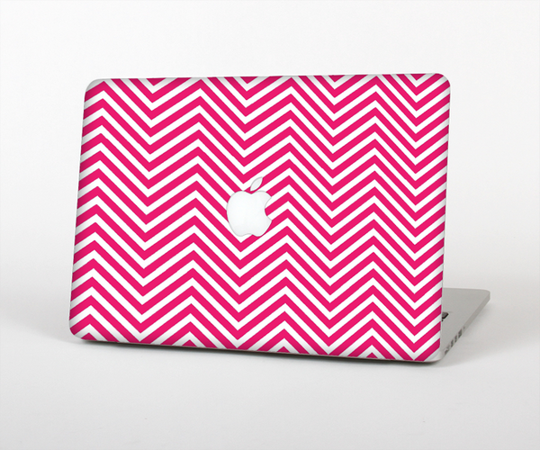 The White & Pink Sharp Chevron Pattern Skin Set for the Apple MacBook Pro 15"