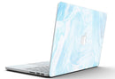Blue_191_Textured_Marble_-_13_MacBook_Pro_-_V5.jpg