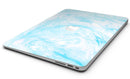 Blue_Textured_Marble_-_13_MacBook_Air_-_V8.jpg