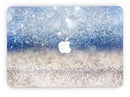 Blue_Unfocused_Silver_Sparkle_-_13_MacBook_Pro_-_V7.jpg