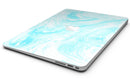 Bright_Blue_Textured_Marble_-_13_MacBook_Air_-_V8.jpg