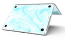 Bright_Blue_Textured_Marble_-_13_MacBook_Pro_-_V8.jpg