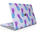 Disco Pineapple - Skin Decal Wrap Kit Compatible with the Apple MacBook Pro, Pro with Touch Bar or Air (11", 12", 13", 15" & 16" - All Versions Available)