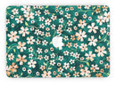 Flowers with Stems over Deep Green Watercolor - MacBook Pro with Retina Display Full-Coverage Skin Kit