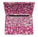 Flowers with Stems over Wine Watercolor - MacBook Pro with Retina Display Full-Coverage Skin Kit