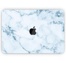 Marble & Digital Blue Frosted Foil V7 - Skin Decal Wrap Kit Compatible with the Apple MacBook Pro, Pro with Touch Bar or Air (11", 12", 13", 15" & 16" - All Versions Available)