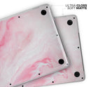Marbleized Pink Paradise V6 // Skin Decal Wrap Kit Compatible with the Apple MacBook Pro, Pro with Touch Bar or Air (11, 12, 13, 15 & 16" - All Versions Available)