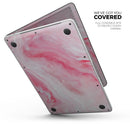Marbleized Pink Paradise V6 // Skin Decal Wrap Kit Compatible with the Apple MacBook Pro, Pro with Touch Bar or Air (11, 12, 13, 15 & 16" - All Versions Available)