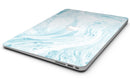 Mixtured_Blue_34_Textured_Marble_-_13_MacBook_Air_-_V8.jpg