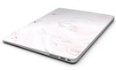 Mixtured_Pink_and_Gray_37_Textured_Marble_-_13_MacBook_Air_-_V8.jpg