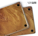 Modern Marble Gold Metallic Mix V6 - Skin Decal Wrap Kit Compatible with the Apple MacBook Pro, Pro with Touch Bar or Air (11", 12", 13", 15" & 16" - All Versions Available)