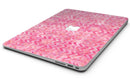 Pink Basic Watercolor Chevron Pattern - MacBook Air Skin Kit