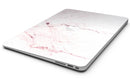 Pink_Splattered_Marble_Surface_-_13_MacBook_Air_-_V8.jpg