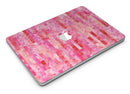 Pink Watercolor Patchwork - MacBook Air Skin Kit