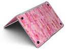 Pink Watercolor Patchwork - MacBook Air Skin Kit