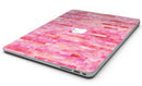 Pink Watercolor Patchwork - MacBook Air Skin Kit