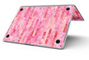 Pink Watercolor Patchwork - MacBook Pro with Retina Display Full-Coverage Skin Kit