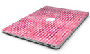 Pink Watercolor Stripes - MacBook Air Skin Kit