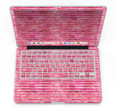 Pink Watercolor Stripes - MacBook Pro with Retina Display Full-Coverage Skin Kit