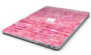 Pink Watercolor Woodgrain - MacBook Air Skin Kit