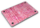 Pink Watercolor Woodgrain - MacBook Air Skin Kit