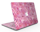 Pink Watercolor Zebra Pattern - MacBook Air Skin Kit