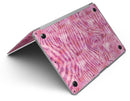 Pink Watercolor Zebra Pattern - MacBook Air Skin Kit