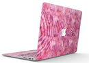 Pink Watercolor Zebra Pattern - MacBook Air Skin Kit
