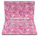 Pink Watercolor Zebra Pattern - MacBook Air Skin Kit