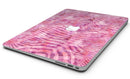 Pink Watercolor Zebra Pattern - MacBook Air Skin Kit