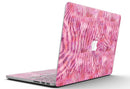 Pink Watercolor Zebra Pattern - MacBook Pro with Retina Display Full-Coverage Skin Kit