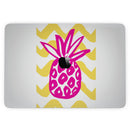 MacBook Pro with Touch Bar Skin Kit - Pink_and_Yellow_Pineapple-MacBook_13_Touch_V3.jpg?