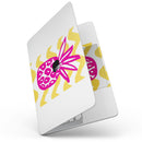 MacBook Pro with Touch Bar Skin Kit - Pink_and_Yellow_Pineapple-MacBook_13_Touch_V7.jpg?