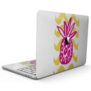 MacBook Pro with Touch Bar Skin Kit - Pink_and_Yellow_Pineapple-MacBook_13_Touch_V9.jpg?