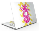 Pink_and_Yellow_Pineapple_-_13_MacBook_Air_-_V1.jpg