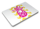Pink_and_Yellow_Pineapple_-_13_MacBook_Air_-_V2.jpg