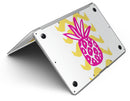 Pink_and_Yellow_Pineapple_-_13_MacBook_Air_-_V3.jpg