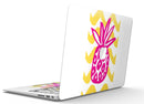 Pink_and_Yellow_Pineapple_-_13_MacBook_Air_-_V4.jpg