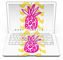 Pink_and_Yellow_Pineapple_-_13_MacBook_Air_-_V5.jpg