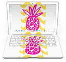 Pink_and_Yellow_Pineapple_-_13_MacBook_Air_-_V6.jpg