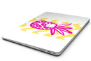 Pink_and_Yellow_Pineapple_-_13_MacBook_Air_-_V8.jpg