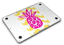 Pink_and_Yellow_Pineapple_-_13_MacBook_Air_-_V9.jpg