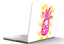 Pink_and_Yellow_Pineapple_-_13_MacBook_Pro_-_V5.jpg