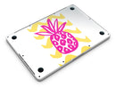 Pink_and_Yellow_Pineapple_-_13_MacBook_Pro_-_V6.jpg